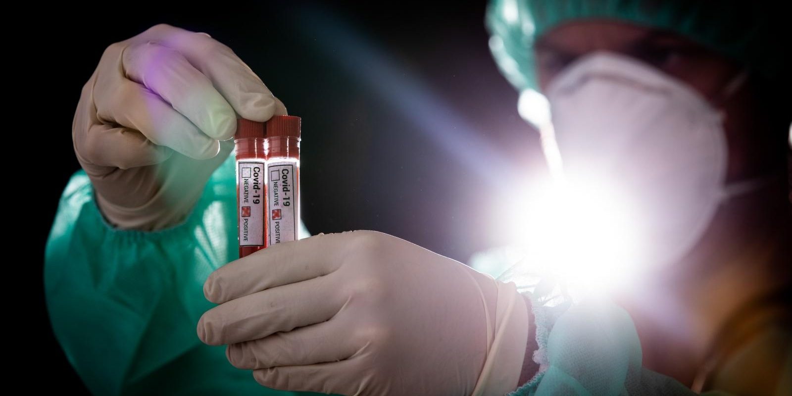 Epruvete s uzorcima krvi – testiranje na koronavirus