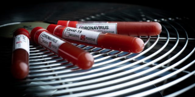 Epruvete s uzorcima krvi – testiranje na koronavirus