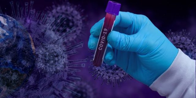 covid-19-4982910_1920-696×382