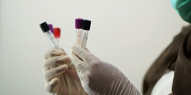 laboratory-5601435_640