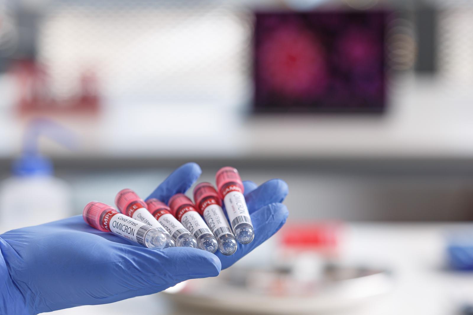 Val epidemije izazvan omikronom i dalje uzrokuje velik broj novozaraženih