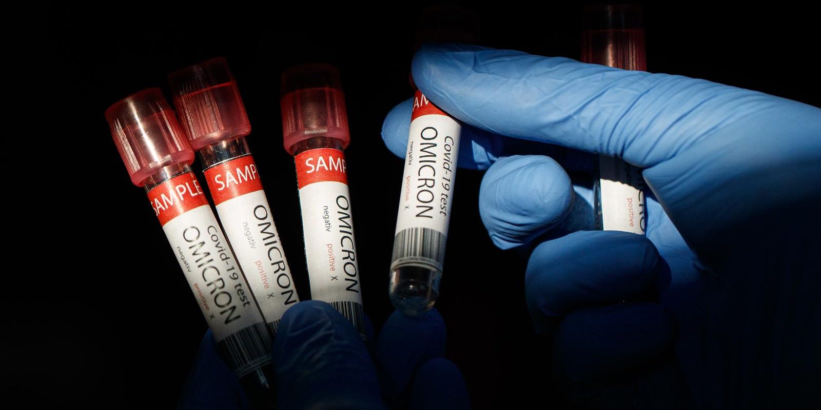 Val epidemije izazvan omikronom i dalje uzrokuje velik broj novozaraženih