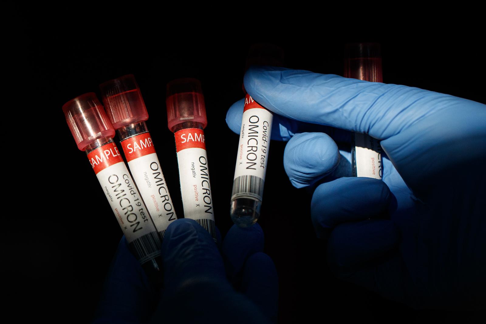 Val epidemije izazvan omikronom i dalje uzrokuje velik broj novozaraženih