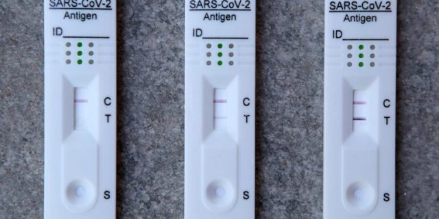 Brzi antigenski test
