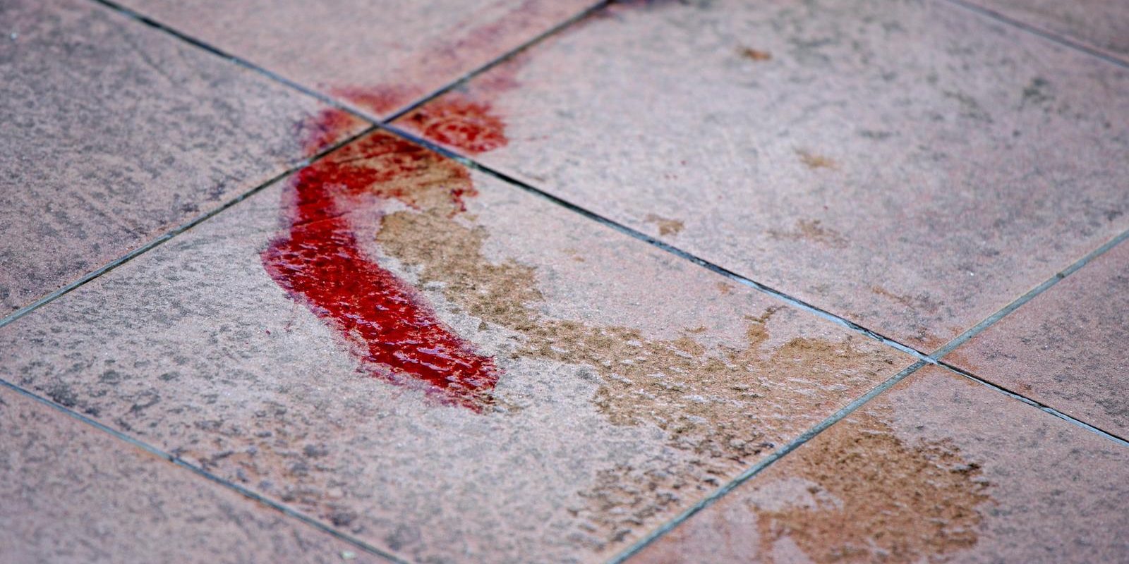 Zagreb: Mu�karac bacio dva psa s tre?eg kata u Prilazu Ivana Visina